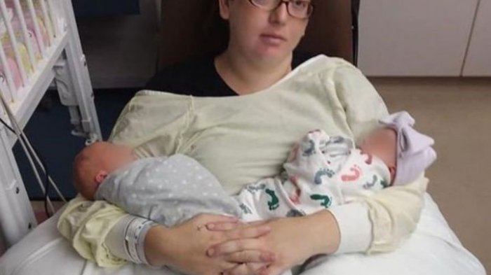 Mujer fue al médico pensando que tenía cálculos renales, pero estaba embarazada de trillizos