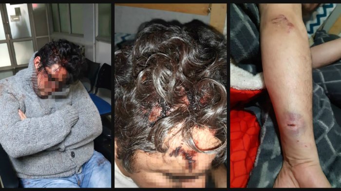 Furioso ataque de turba a un Uber: Lo apuñalaron y mandaron audios de WhatsApp a su esposa para burlarse