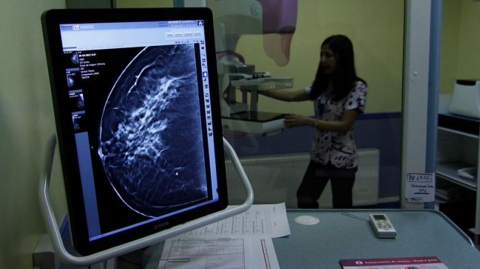 Esta es la forma de detectar el cáncer de mamas que probablemente no conocías