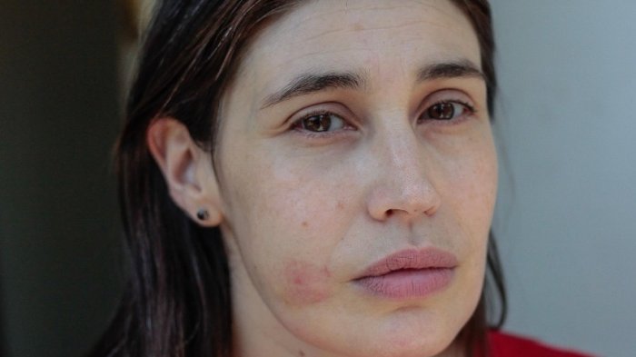 María Paz Grandjean anuncia querella contra Carabineros: “Lo que quiero es justicia y saber quién me disparó”