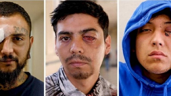 NY Times reúne testimonios de manifestantes que han sufrido daños oculares por disparos de Carabineros