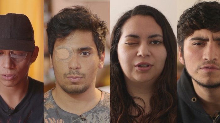 Víctimas de balines y perdigones exigen sanciones para uniformados y el Estado