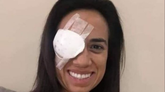Diputada Núñez aclaró por qué circula una foto de ella con un parche en el ojo