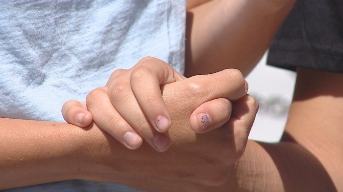 Joven fue impactada por una lacrimógena en el rostro y perdió tres de sus piezas dentales