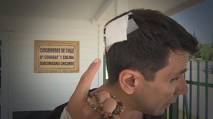 “Parecía película”: El relato de Juan Pablo Queraltó tras sufrir violento robo