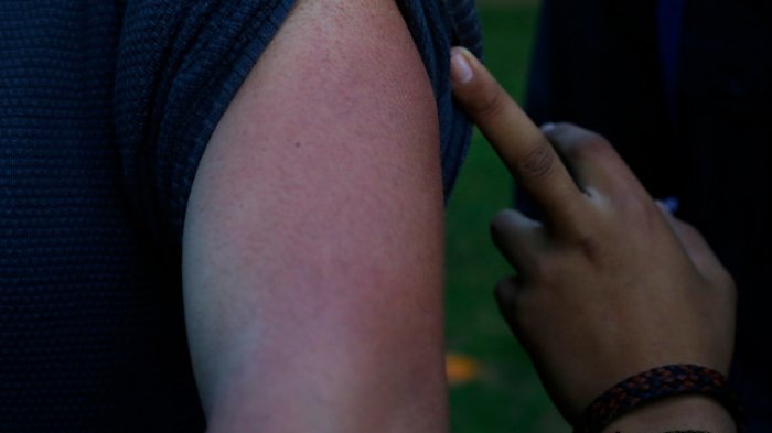 Denuncian que Carabineros estaría usando un químico prohibido en los protocolos para dispersar manifestaciones