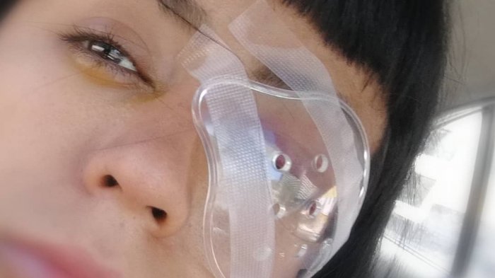 Fotoperiodista que recibió impacto en su ojo en Año Nuevo responsabiliza a Carabineros: 