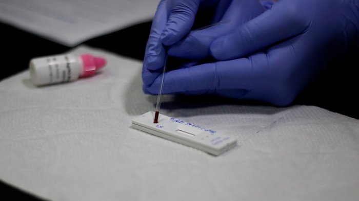 Casos notificados con VIH en Chile aumentaron en un 30,9% en el 2019