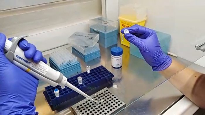 Llega a Chile el kit de detección rápida para el coronavirus