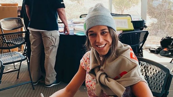 Impactante antes y después de una luchadora de UFC que quedó con su rostro desfigurado