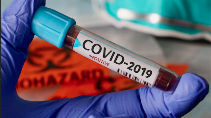 ¿Cómo puede llegar a causar la muerte el coronavirus?