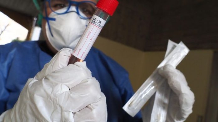 España compró test rápidos de coronavirus defectuosos: China asegura que el productor no tenía licencia