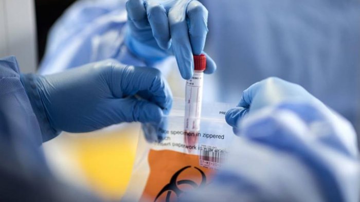 Farmacéutica que desarrolla el Remdesivir se disparó en la bolsa tras favorables pruebas en pacientes con COVID-19