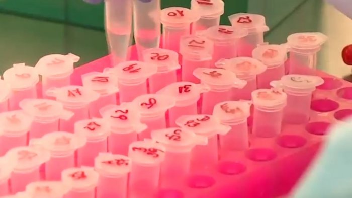 Sumar a los asintomáticos: La nueva forma de contar casos de coronavirus