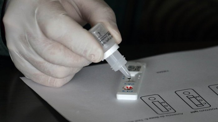Así funcionan los test rápido de COVID-19 presentados por el gobierno
