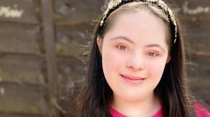 Ella es Ellie Goldstein, la modelo con síndrome de Down que triunfa en Gucci