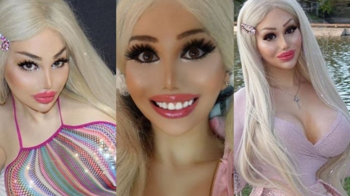 Gastó $80 millones para ser como Barbie y no podía trabajar: Dijo que la acosaban por ser “demasiado sexy”