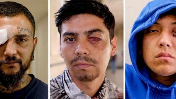 Reportaje del NYT que reunió testimonios de víctimas de daños oculares durante las protestas en Chile es nominado al Emmy