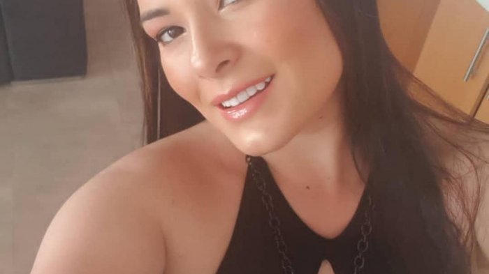 Mujer quedó calva luego que le lanzaran pegamento corrosivo en la cabeza: Acusa que fue un ataque por celos