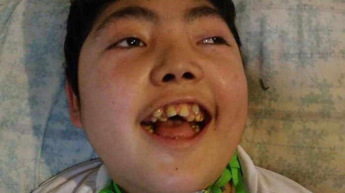 Insólito: Adolescente con daño neurológico lleva 14 años esperando una pensión de invalidez