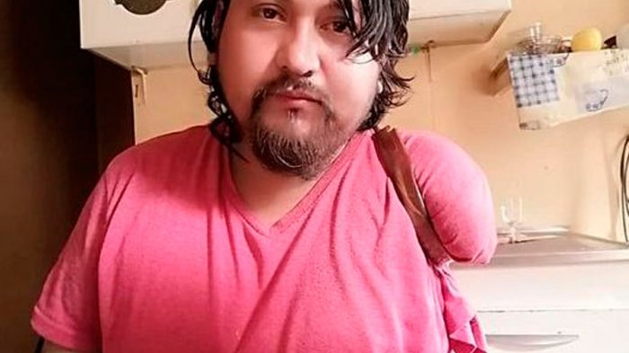 Perdió sus brazos y piernas, vive con abuelos discapacitados y pide ayuda para mantenerlos