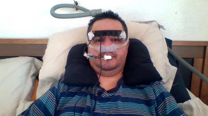 Padece ELA y quiere trabajar, pero necesita impresora y computador especial