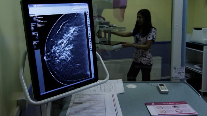 Clínicas móviles hacen mamografías: Cómo y dónde acceder al examen gratuito