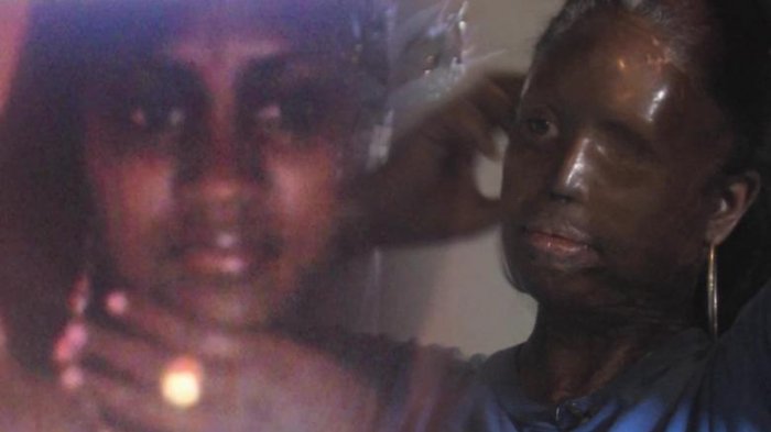 La historia de la mujer desfigurada por ataque con “acido del diablo” que se convirtió en influencer