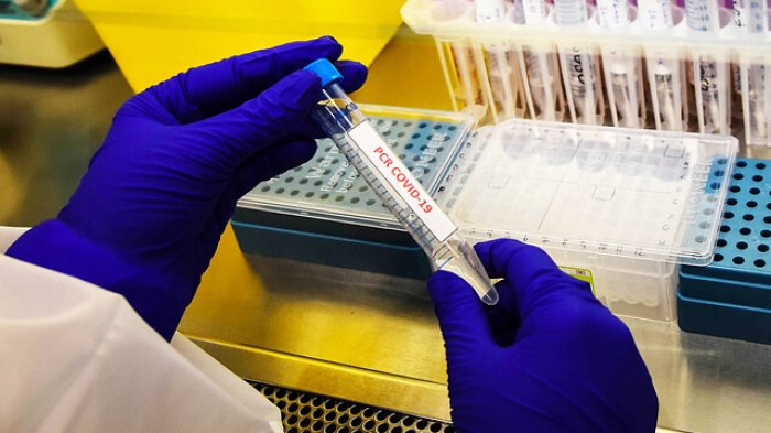 EE.UU. vuelve a batir su récord de contagios: Más de 120 mil en un día