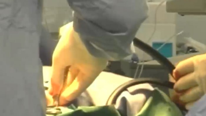 Médico tendrá que pagar $760 millones de indemnización por negligencia en cirugía bariátrica