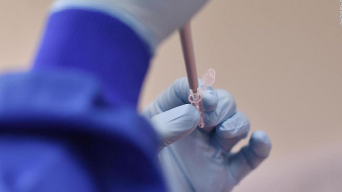 Se realizó tres pruebas de COVID-19 y resultaron falsas, pese a tener todos los síntomas