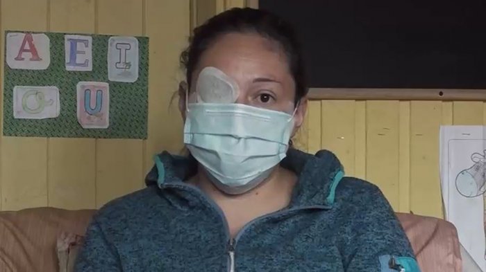 Decretaron prisión preventiva para ex pareja de mujer atacada con ácido