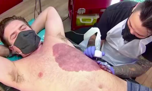 Su hijo no se quería sacar la polera por su marca de nacimiento: Fue y se tatuó la misma mancha