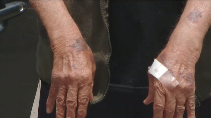 Adulto mayor de 86 años fue asaltado y golpeado: Delincuentes usaban placa falsa de la PDI