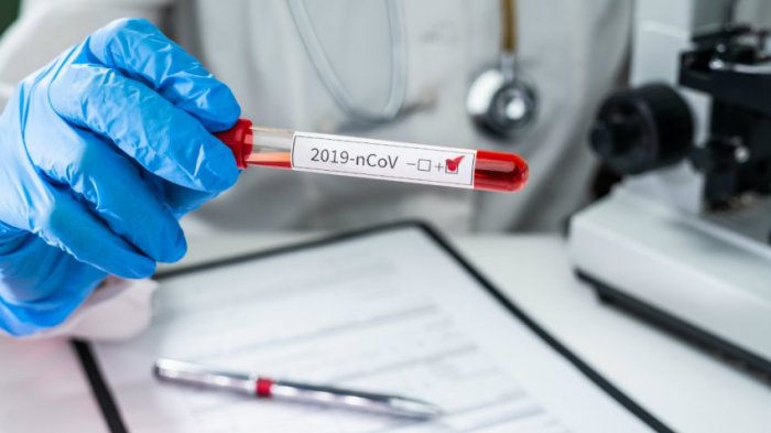 Científicos advierten que no se puede descartar que nueva variante del coronavirus ya esté en Chile