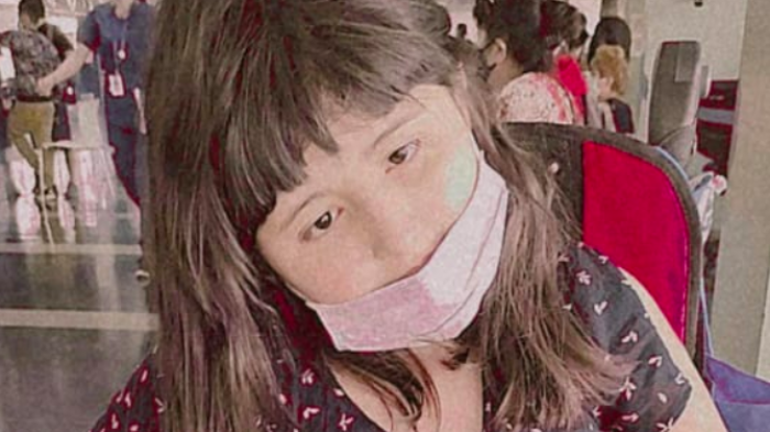 Necesitan una cirugía: La compleja espera de Ignacia, la menor de 11 años que sufre de epilepsia refractaria y apnea