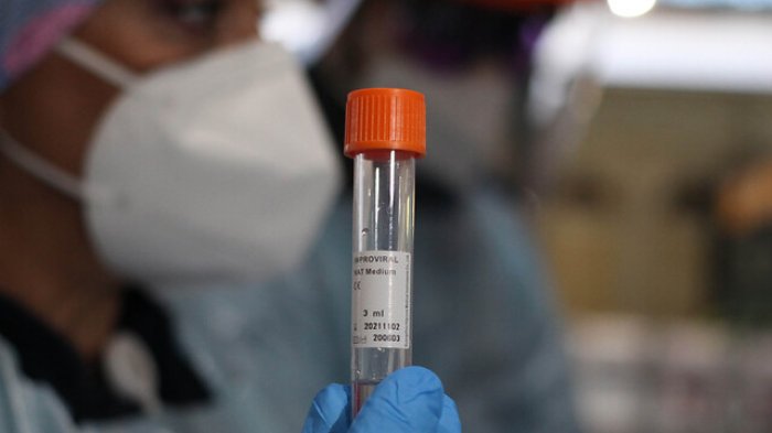 Alemania investiga una nueva variante de COVID-19