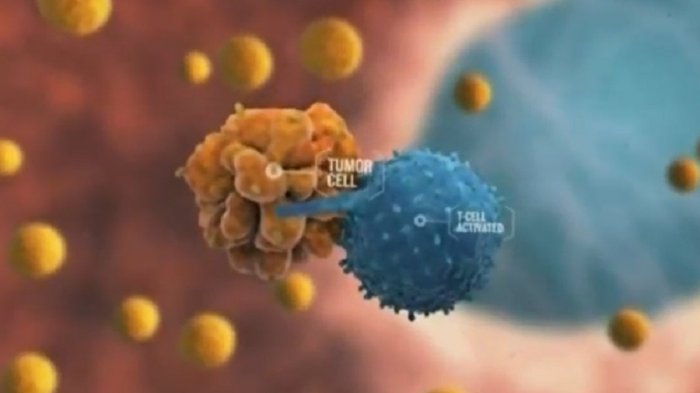 IA predice qué pacientes reaccionarán mejor a tratamientos contra el cáncer