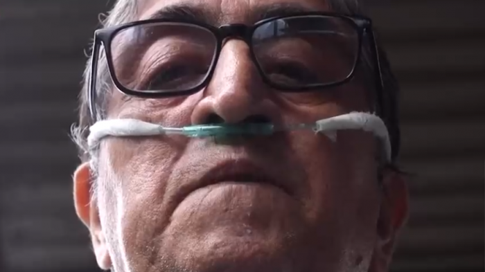 Pacientes con fibrosis pulmonar luchan por costear tratamiento: 