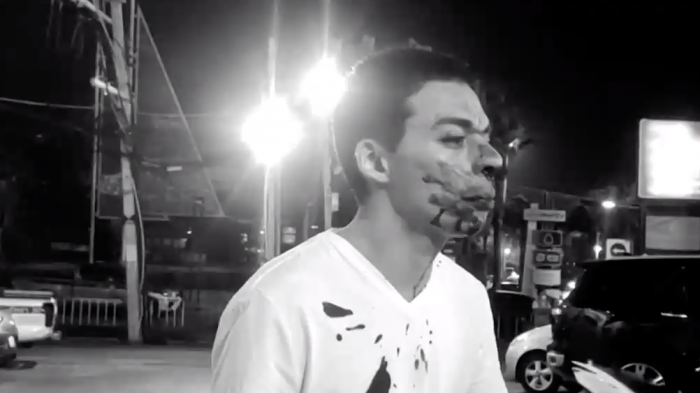 Brutal golpiza a joven chileno en Tailandia: Mototaxista lo atacó tras no entenderle en inglés