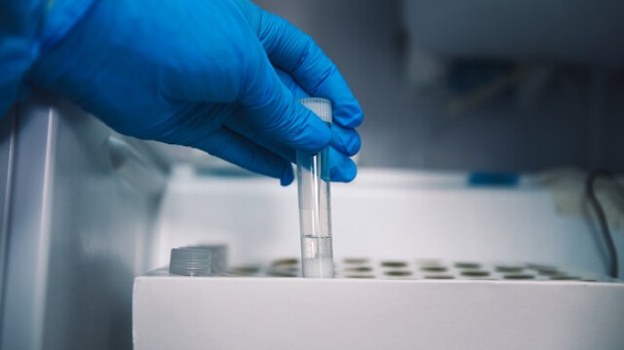 Chile alcanza 9.171 nuevos casos de COVID-19, por lejos la cifra más alta en toda la pandemia