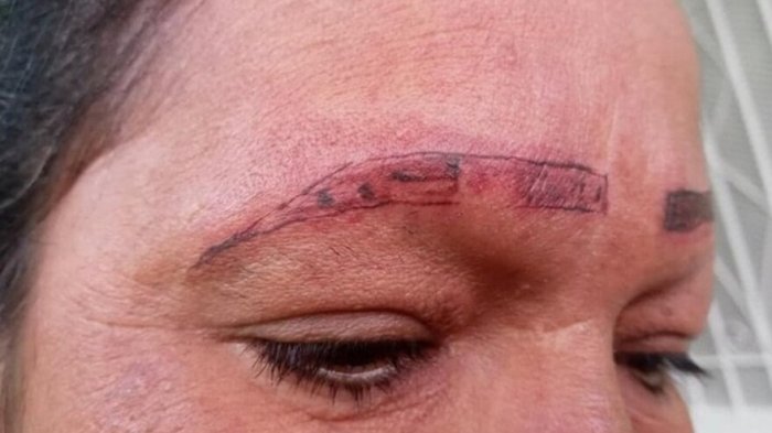 Mujer fue por tatuaje para definir sus cejas y terminó con cicatrices y quemaduras