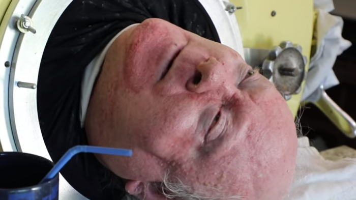 La historia del hombre que lleva 70 años sin moverse y vive gracias a un 