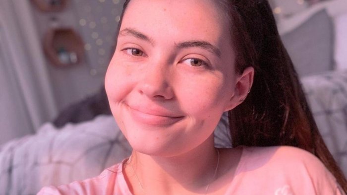 Joven estadounidense es alérgica a su propio sudor y lágrimas: Sufre de extraña reacción al agua