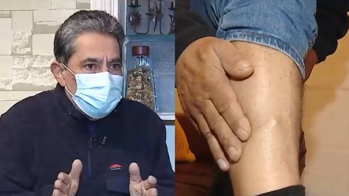 Hombre tiene una aguja en su pierna: Acusa que llegó a su cuerpo tras estar hospitalizado por COVID-19