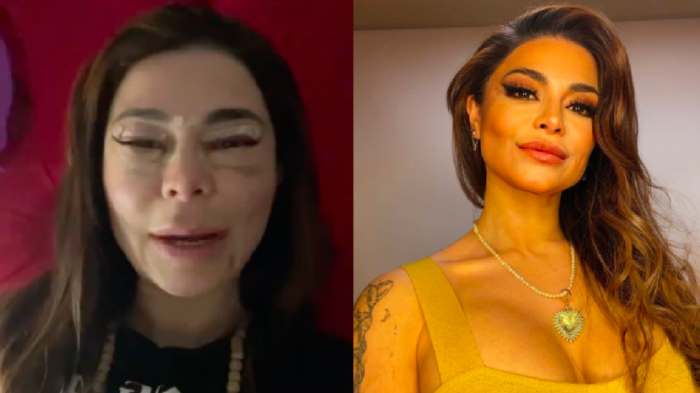 Antonella Ríos compartió video en el que muestra el proceso de su intervención en los ojos