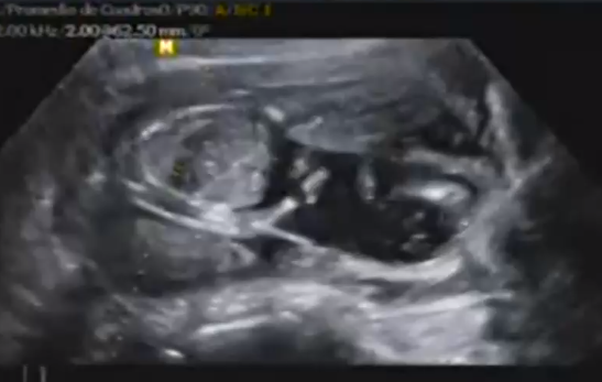 Tuvo al hijo de su amiga: Histórico fallo del Tribunal de Familia en caso de vientre de alquiler