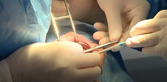 Mujer denuncia polémica intervención dental en el sistema público: 