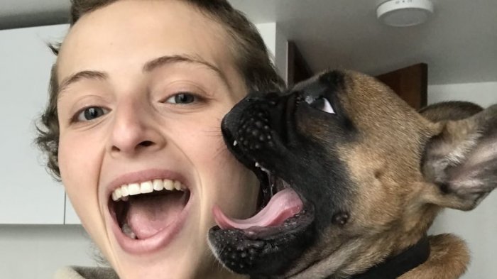 Campaña busca hallar gemelo genético para joven de 24 años con leucemia linfoblástica aguda