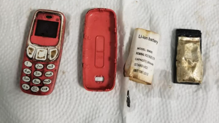 ¿Cómo llegó ahí? Hombre sintió fuertes dolores y médicos descubrieron que tenía un celular en su estómago